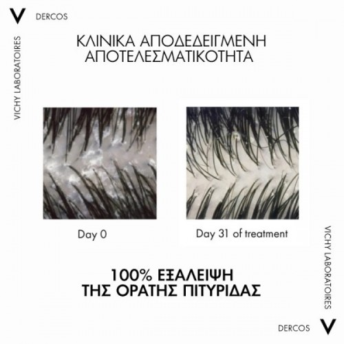 VICHY DERCOS ANTI-DANDRUFF 2IN1 ΑΝΤΙΠΙΤΥΡΙΔΙΚΟ ΣΑΜΠΟΥΑΝ & CONDITIONER 390ml